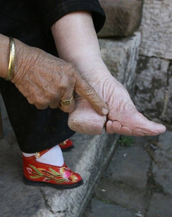 Most shocking cultural traditions, Foot-binding